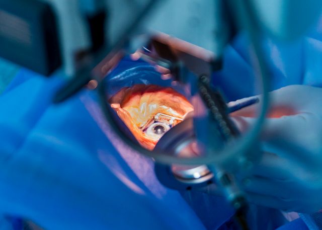 Symbolfoto Augenoperation