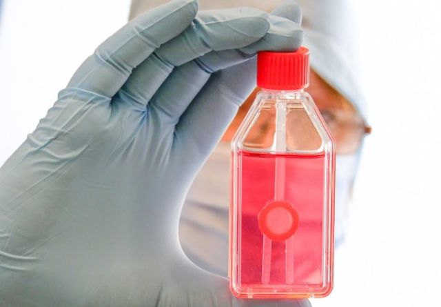 Behandschuhte Hand hält Fläschchen mit Augenhornhautpräparat