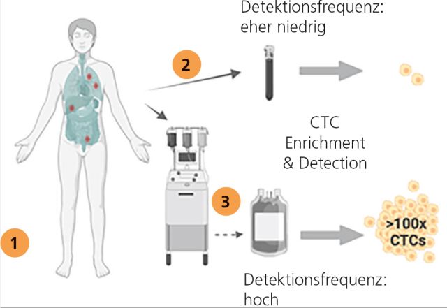 © Nikolas H. Stoecklein, Universitätsklinikum Düsseldorf