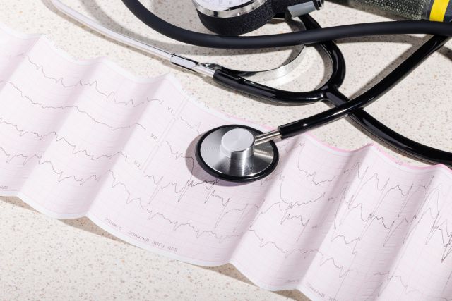 EKG-Ausdruck auf einem Tisch mit medizinischen Geräten im Hintergrund