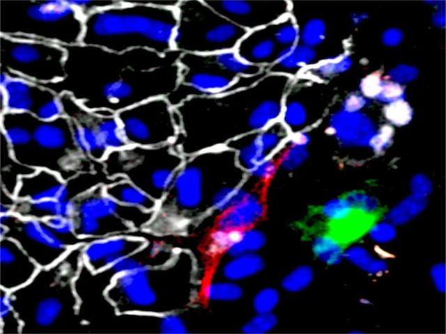 Fällt das Wächtermolekül aus, entstehen anstatt Leberzellen (grau) auch Muskel- (rot) oder Nervenzellen (grün).