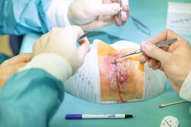 Chirurgen arbeiten mit 3D-Augenlid-Modell