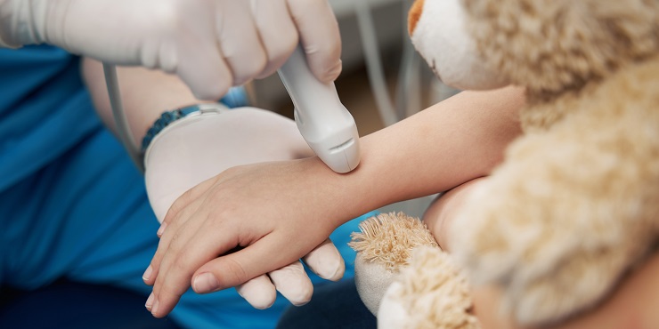 Hand eines Arztes mit Schallkopf führt Sonografie am Handgelenk eines Kindes durch