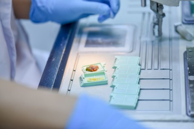 Darstellung eines Laborprozesses zur Untersuchung von Tumorgewebe im Zusammenhang mit Biopsien.
