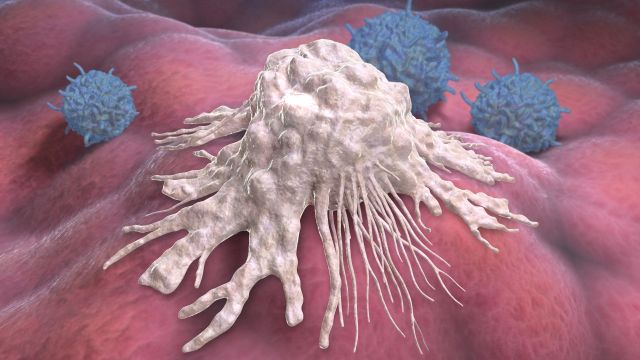 Darstellung einer dendritischen Zelle im Kontext der Krebsbehandlung.