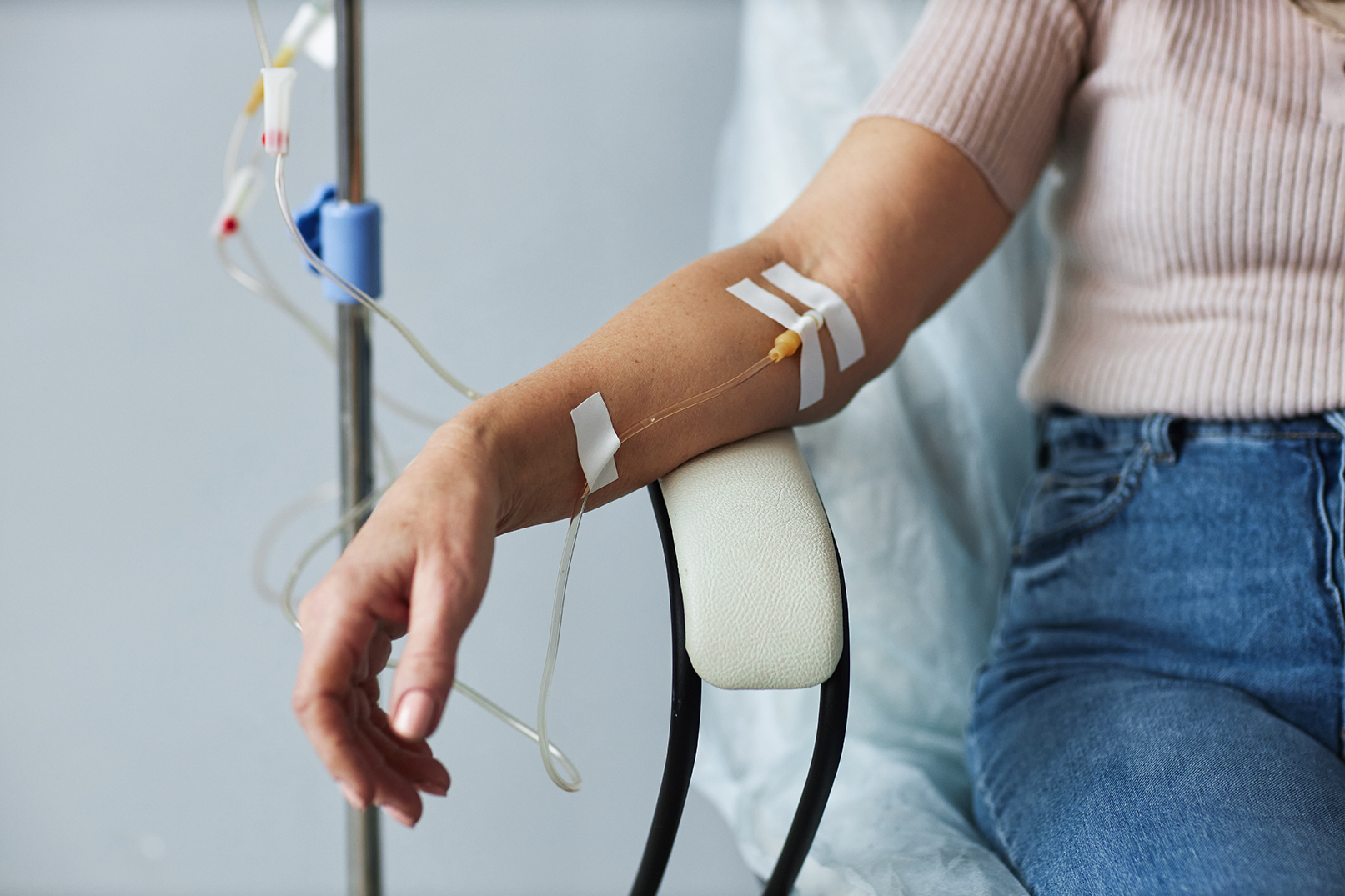 Nahaufnahme eines Arms während einer intravenösen Therapie mit einem Katheter und Schläuchen in einer medizinischen Umgebung.