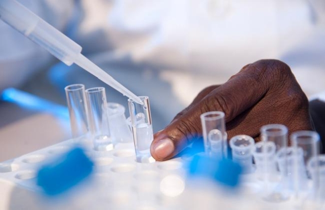 Hand eines Wissenschaftlers, der mit einer Pipette Flüssigkeit in ein Reagenzglas füllt, symbolisiert Labortests und Qualitätskontrolle.