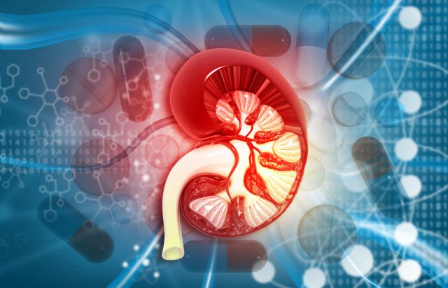Grafische Darstellung einer Niere mit Fokus auf nicht-klarzellige Nierenzellkarzinome und medizinische Forschung