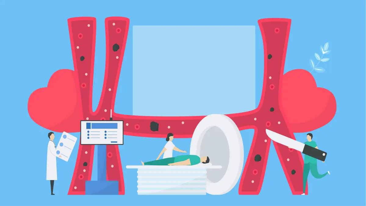 Kardiologische Vektorillustration der Herzgefäße mit 2 symbolischen Herzen, Arzt der Ergebnisse hält daneben ein Monitor, Patient der von einer Schwester in ein MTR oder CT geschoben wird und Chirurg der mit einem Messer läuft.