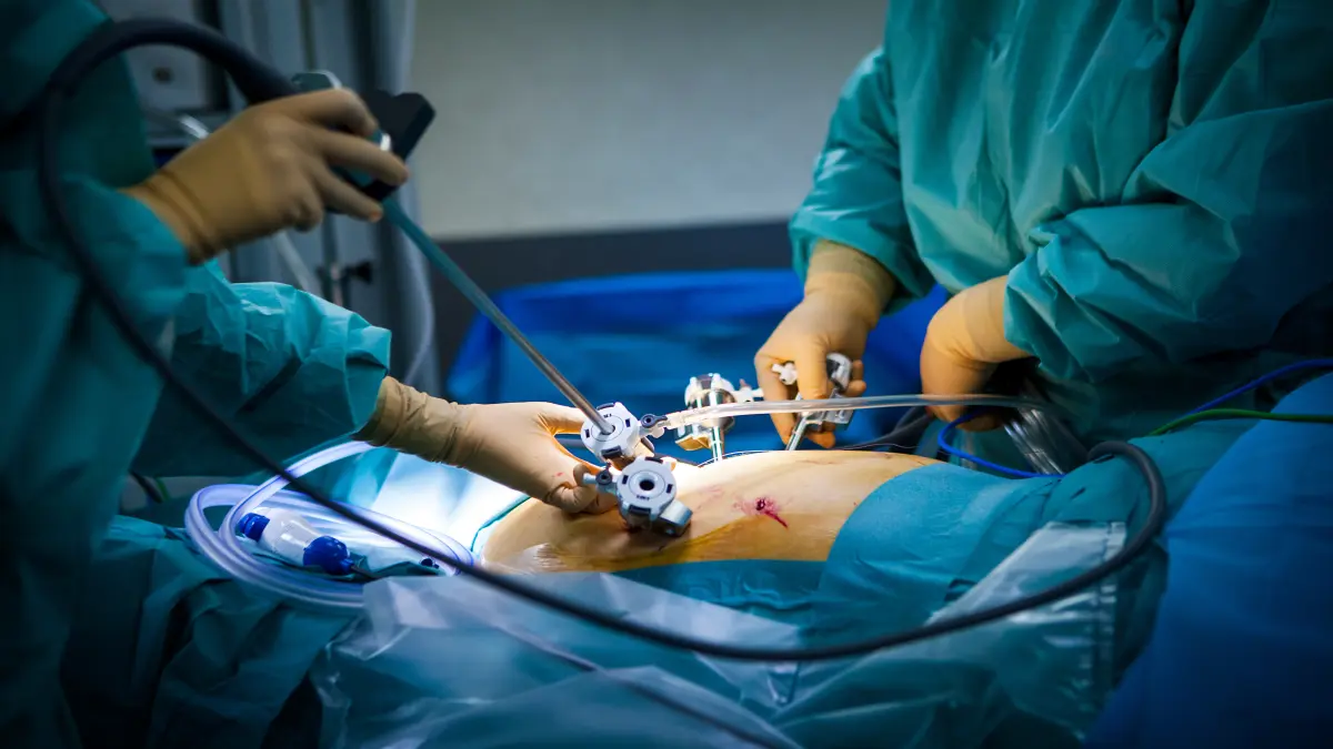 Roboterassisitierte Hysterektomie in einem OP-Saal.