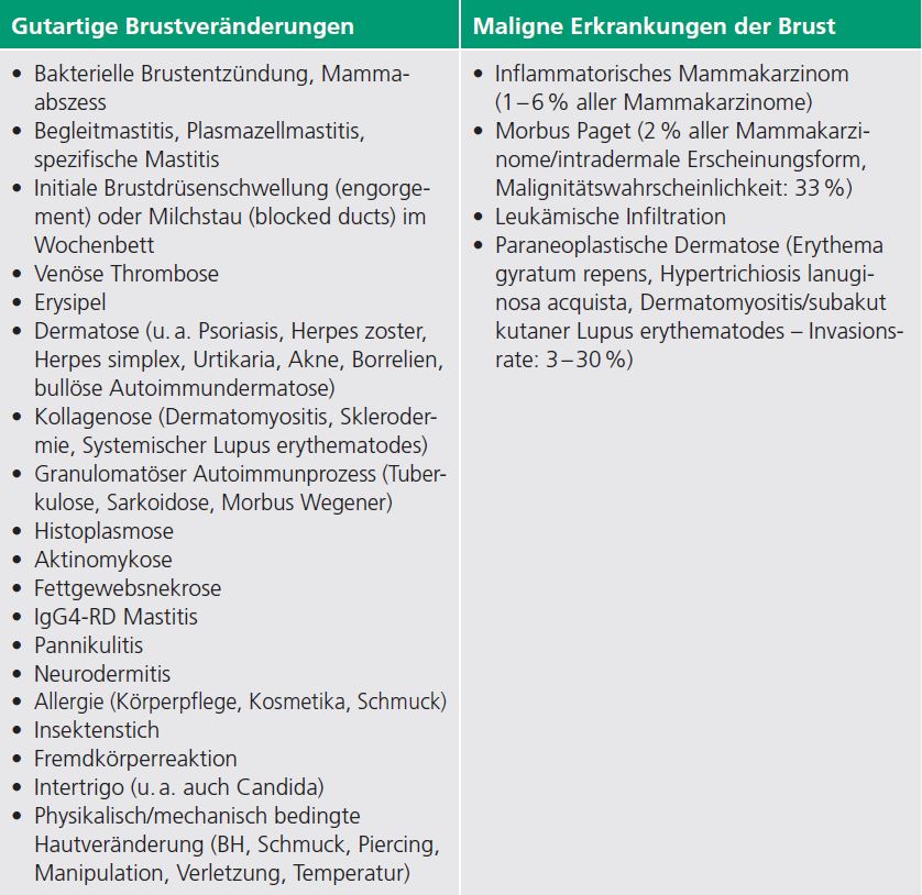 Tab. 1: Inflammatorisches Erscheinungsbild der weiblichen Brust – Was steckt dahinter
[17–22]?