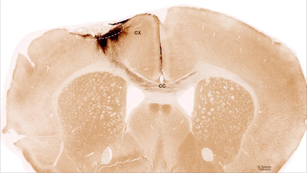 querschnitt mausegehirn