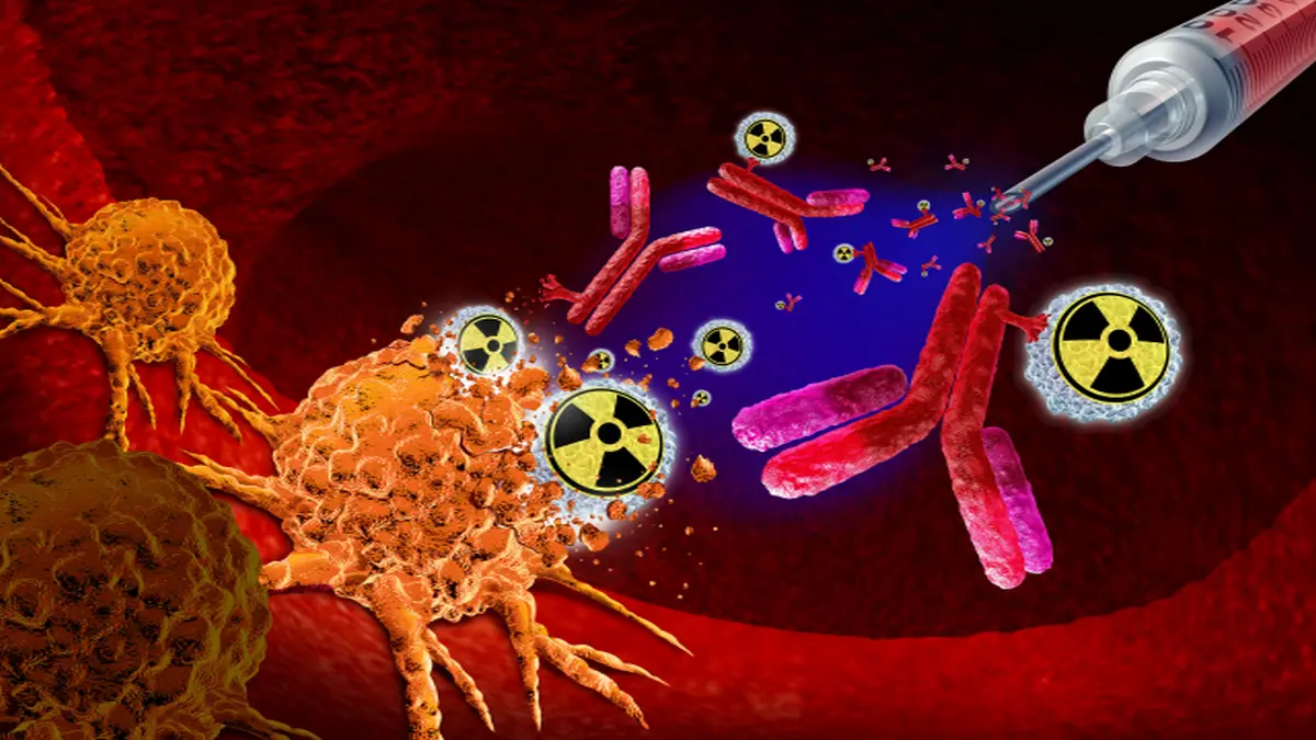 3D-Darstellung: Radioaktive Antikörper in der Krebstherapie zur Zerstörung von Tumorzellen.