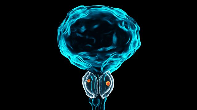 Medizinische Darstellung der Prostata mit Fokus auf innovative Bildgebungstechnologien für Prostatakrebs