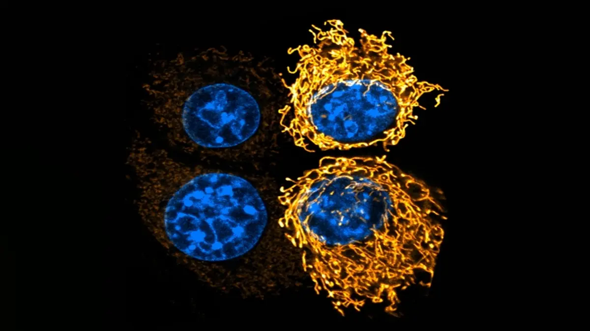 Krebszellen verändern die Form ihrer Mitochondrien (gelb), in saurer Umgebung. Das zusammengesetzte Bild zeigt zwei Zellen unter neutralem pH-Wert (links) im Vergleich zu einer sauren Umgebung (rechts), in der die Mitochondrien längliche Netzwerke bilden