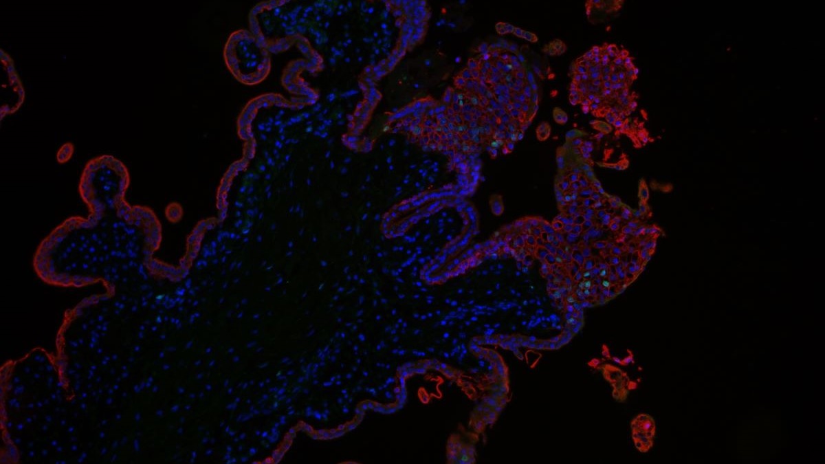 Die gefärbten Zellen sind Trophoblasten des Plazentagewebes. © Rabia Anwar