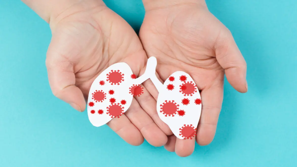 Symbolische Darstellung einer Lungeninfektion durch Respiratorisches Synzytial-Virus mit roten Viruspartikeln auf weißen Lungenmodellen, die von Händen gehalten werden.