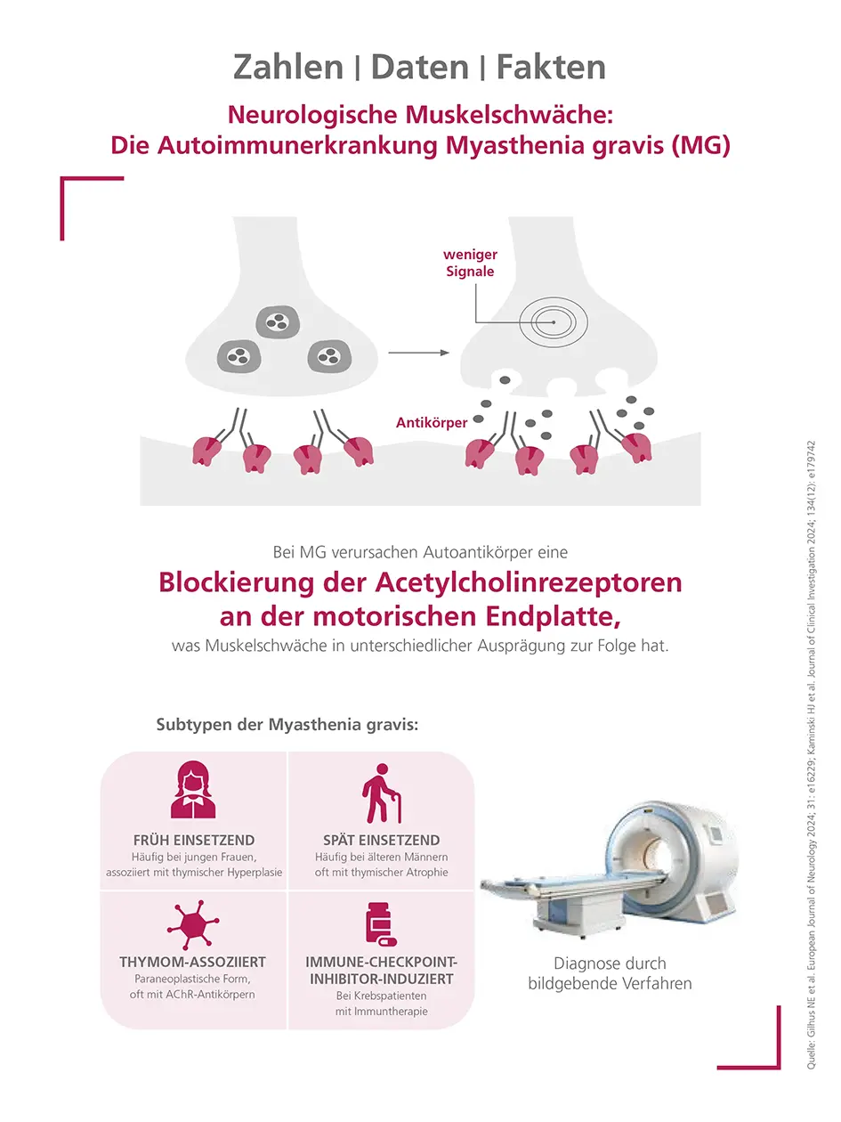 Neurologische Muskelschwäche: Die Autoimmunerkrankung Myasthenia gravis (MG)