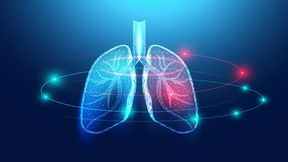 Digitale Darstellung von menschlichen Lungen mit Krebs.