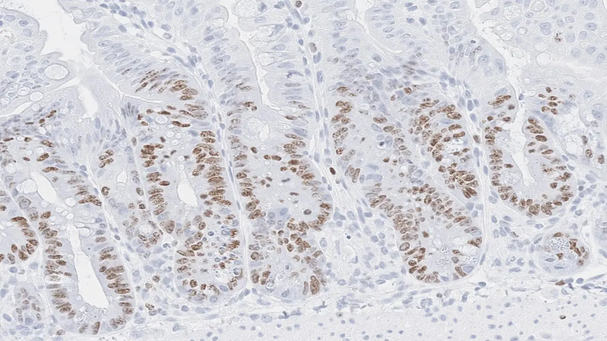 Mikroskopische Aufnahme von proliferierenden Epithelzellen im Darm nach Bestrahlung des Bauchraums. 